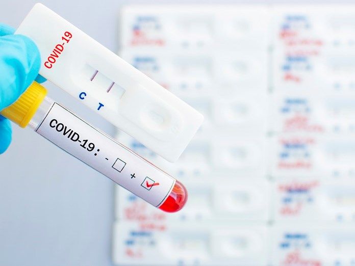 EODY reports 27 new cases of Covid-19 in Corfu today - 18 October