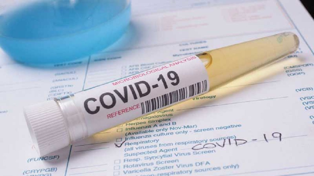 EODY reports 91 new cases of Covid-19 in Corfu today - 29 November