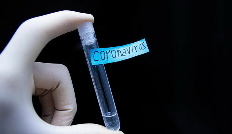 EODY: 269 new cases of coronavirus in Greece today